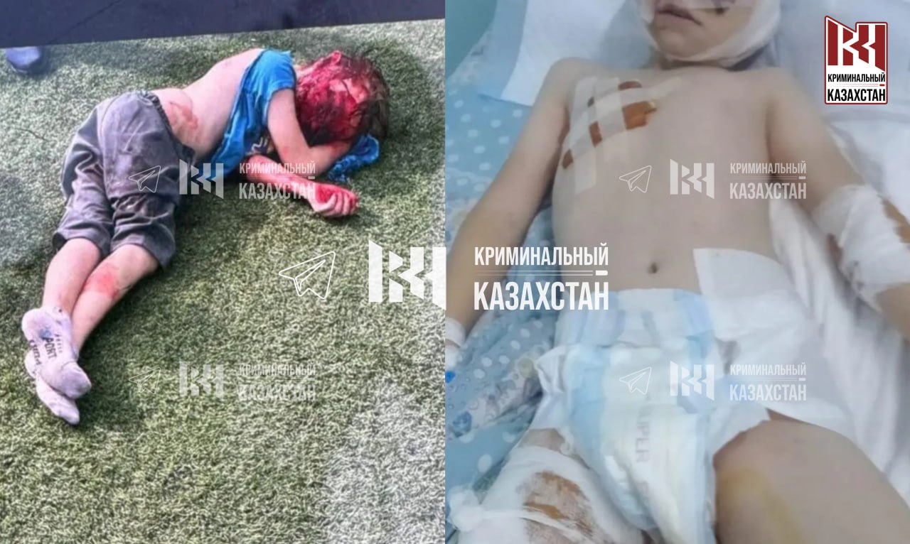 Бойцовские собаки растерзали мальчика в Алматинской области