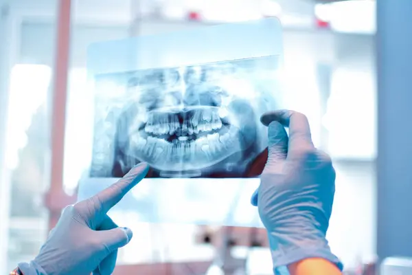 depositphotos 711007220 stock photo female dentist holding dental ray